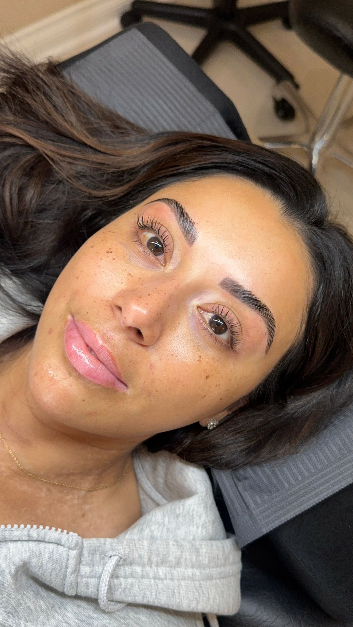 Close-up of a woman with dark hair lying down, wearing a light gray hoodie, in a clinical setting.